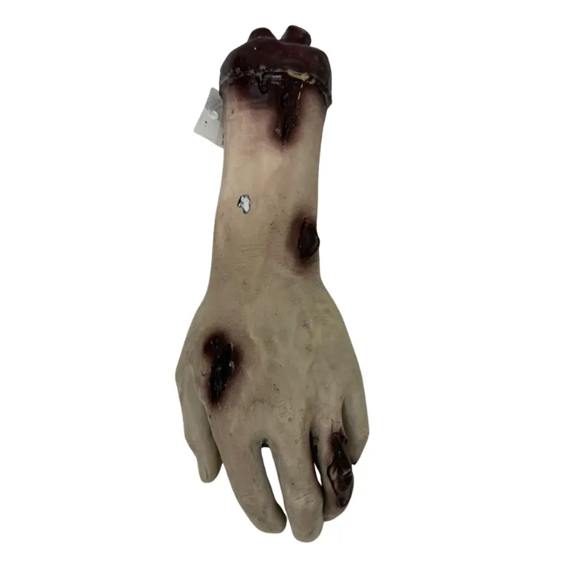 Skin Colour Broken Hand